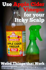 apple cider vinegar for itchy scalp