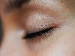 dark eyelids causes remes and