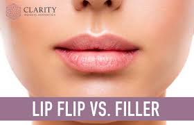 lip flip vs filler everything you
