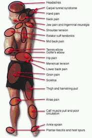Pain Chart For Fibro And Chronic Pain Fibromyalgia
