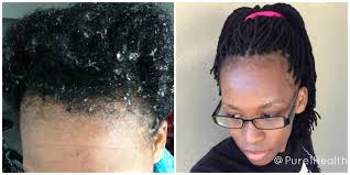 Never pull your individual braid extensions back tightly or in the same direction day to day. Yarn Braids Protective Style Preparing My Natural Hair For Braids Natural Hair Styles Braided Hairstyles Beautiful Hair