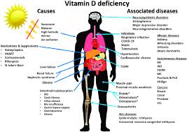 vitamin d deficiency and diseases