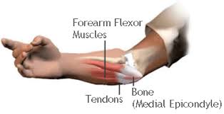 It is important in the motion called supination of the forearm. Corp Med Tendonitis Is Inflammation Of The Tendons Particularly Where They Attach A Muscle To A Bone