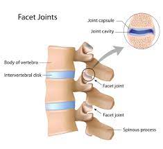 symptoms treatment of facet joint pain