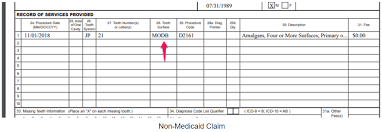Medicaid Alphabetical Tooth Ordering