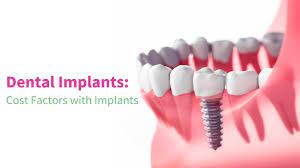 dental implants cost noida