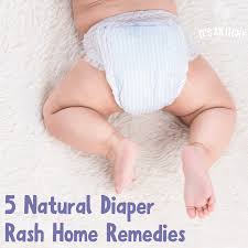 5 natural diaper rash home remes