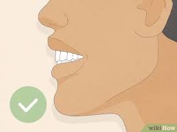 Having said that, there's such a thing as too much of an overbite.when left untreated, overbite teeth can lead to all sorts of problems. 7 Ways To Fix An Overbite Wikihow