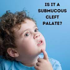 child have a submucous cleft palate
