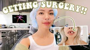 i m getting surgery before after