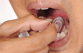 treating tooth infection through home