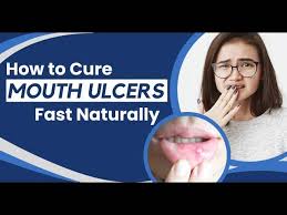 mouth ulcers how to get rid of mouth