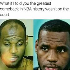 So at least have a laugh about it and enjoy these funny hairline roasts and jokes. Trending Current Events