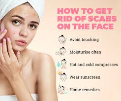 how to heal scabs on face be