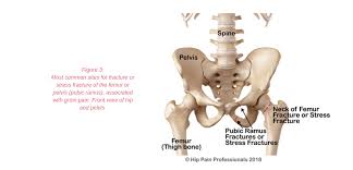 Howe recommends powders, especially in the groin, to help soak up excess moisture and help prevent skin from rubbing too much. Groin Pain Structures And Conditions That Can Contribute To Groin Pain