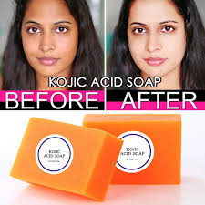 Dark Black Skin Lightening Soap Kojic Acid Whitening Soap Kojic Acid Glycerin Brighten Face Body Skin Bleaching Soap Soap Aliexpress