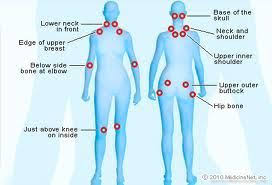 Pin On Healing Fibromyalgia