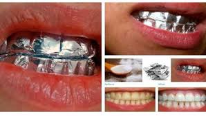 Over the years, use of coffee, tea, cigarette, tobacco and other substances has been associated with teeth discoloration. This Is What Happens When You Wrap Your Teeth In Aluminum Foil For 1 Hour I Creative Ideas