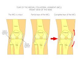 collateral ligament injuries chris