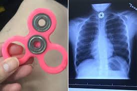 Mom says a fidget spinner nearly killed her kid New York Post