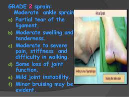It is not as severe as a grade 3, but definitely more serious than a grade 1 sprain. Ankle Sprains