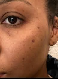 fade serum dark spots pigmentation
