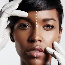 Why It S Time All African Countries Took A Stand On Skin Lightening Creams