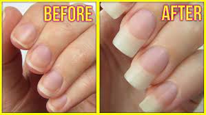 We did not find results for: Diy Nail Growth Serum