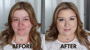 acne textured skin makeup tutorial