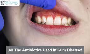 antibiotics used in gum disease