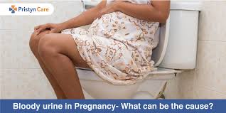 urine in pregnancy what can be