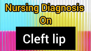 nursing diagnosis on cleft lip