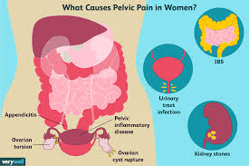 pelvic pain where it s located