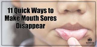 mouth sores disappear