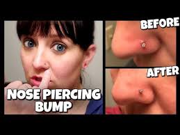 get rid of a nose piercing p fast