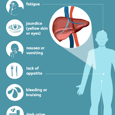 Hepatitis C Symptoms and Complications