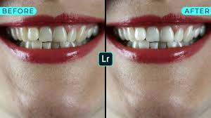 Maybe you would like to learn more about one of these? How To Whiten Teeth In Adobe Lightroom Youtube