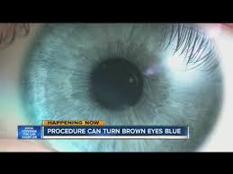 procedure can turn brown eyes blue