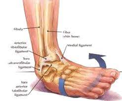 ankle sprain ankle dr ben beamond