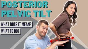 Posterior Pelvic Tilt | What Does It Mean & How To Fix It! - YouTube