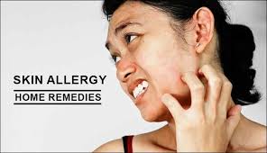home remes to get rid of skin allergies