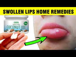 how to treat swollen lips naturally at