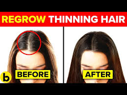 13 ways to regrow your hair naturally