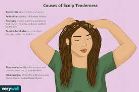 scalp pain and soreness causes