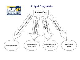 The Endo Blog Pulpal Periapical Diagnosis