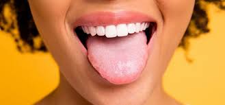 scalloped tongue pro teeth guard