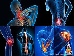 Beberapa contoh keabnormalan tulang belakang skoliosis, kifosis, dan lordosis akan menyebabkan lengkungan yang tidak normal di bagian tulang belakang. Punca Sakit Tulang Belakang Ketika Bangun Tidur Sentiasa Panas