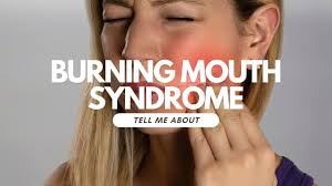 burning mouth syndrome health