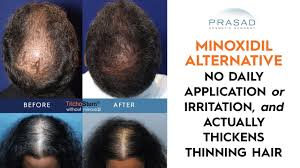 trichostem hair regeneration treatment