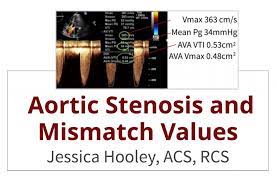 aortic stenosiismatch values